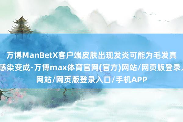 万博ManBetX客户端皮肤出现发炎可能为毛发真菌感染和细菌感染变成-万博max体育官网(官方)网站/网页版登录入口/手机APP